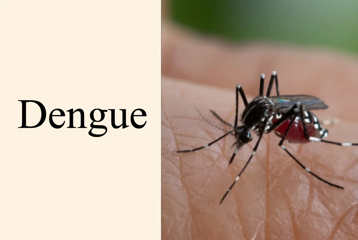Dengue